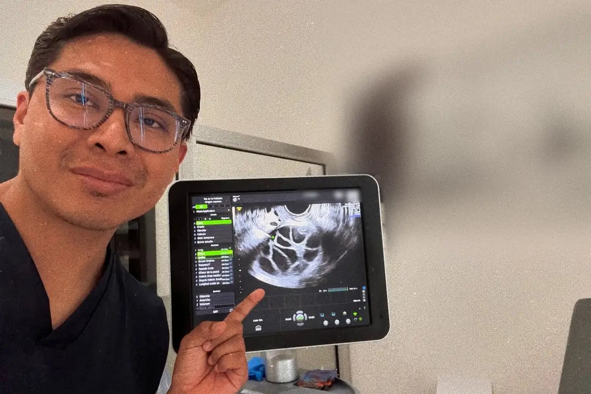 El Dr. Javier Piri señala la imagen en la pantalla del ultrasonido